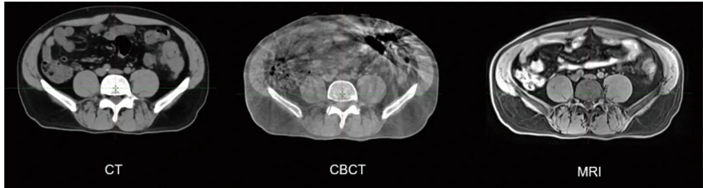Comparison of CT, CBCT and MRI images (official hospital material)